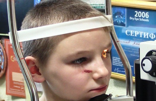 мальчик, пострадавший при обстреле Донецка