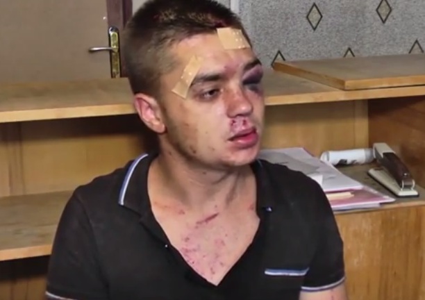 Пленный украинский гранатомётчик :  я шёл на войну под страхом тюрьмы(видео)