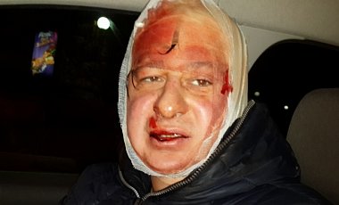 В Киеве пострадали 40 журналистов. Список обновляется