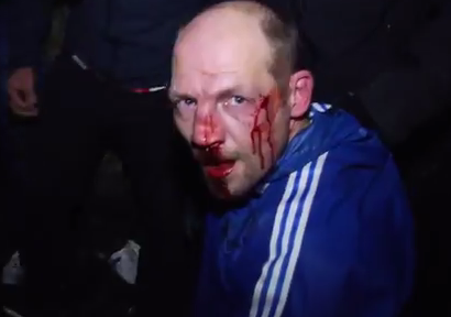 Ну, конечно, Фашизма в Украине нет. Просто избивают людей за их мнение (видео)